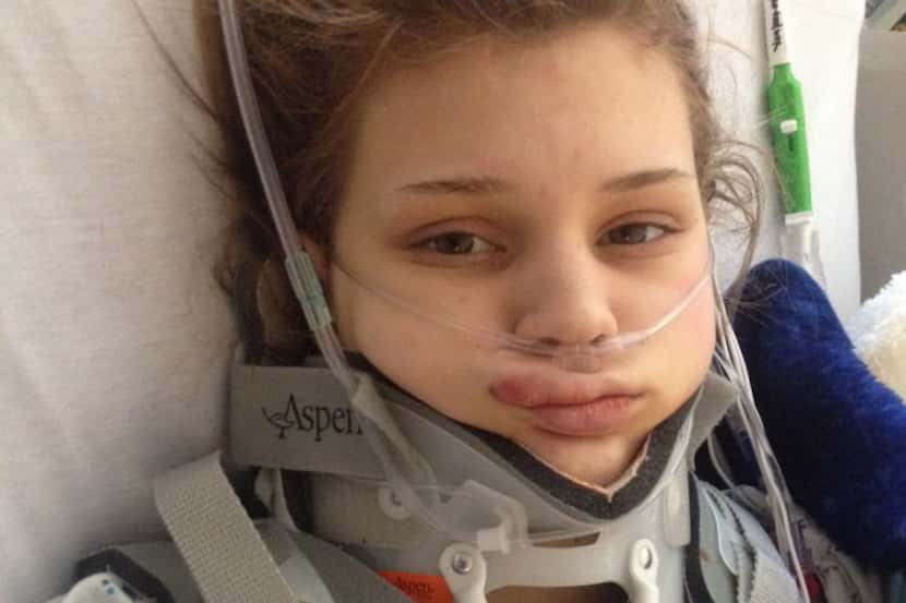 Makenzie a short time after the January 2014 accident. (Oklahoma University Medical Center)