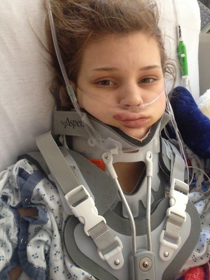 Makenzie a short time after the January 2014 accident. (Oklahoma University Medical Center)