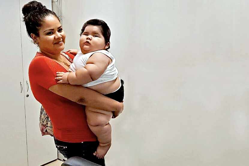 Con un diagnóstico inicial de obesidad mórbida, el bebé es atendido por médicos de distintas...