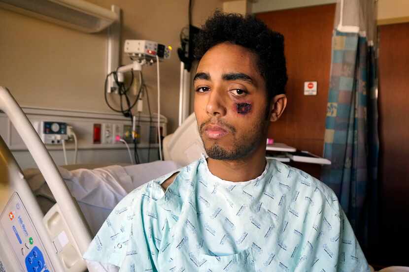Vincent Doyle said he was struck by a so-called less lethal bullet during a May 30 protest...