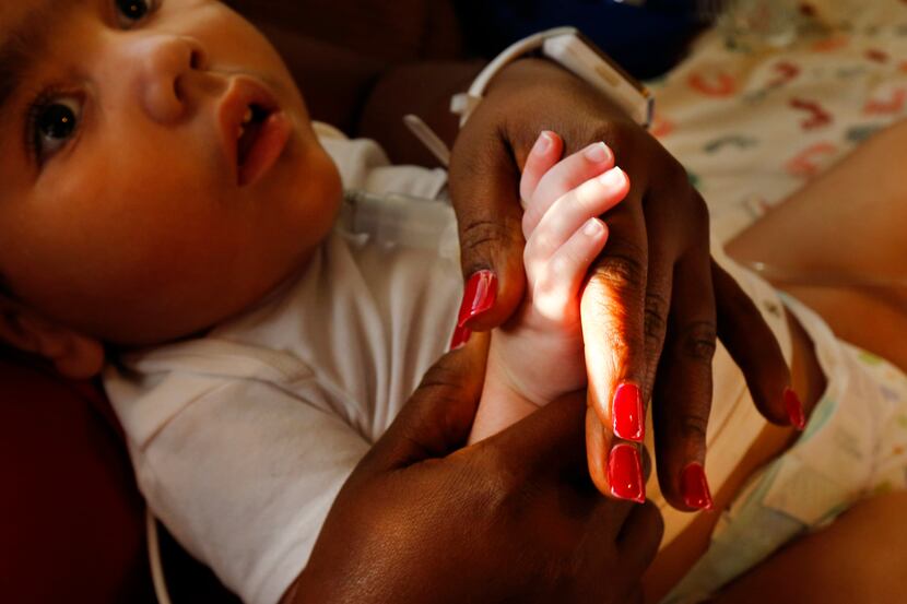 Linda Badawo, who was D'ashon's foster mother before she adopted him, stretches his fingers...