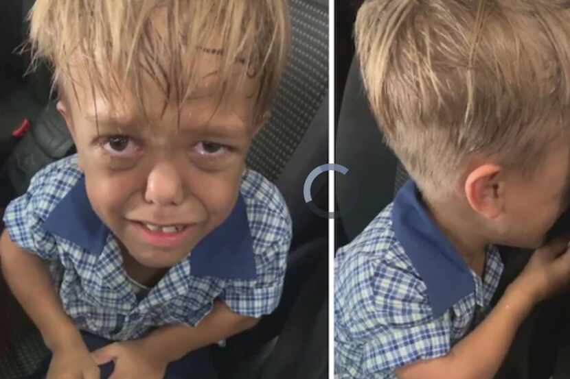 Quaden Bayles de 9 años sufrió bullying por su estatura. Su video llorando se hizo famoso.