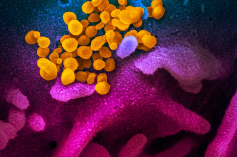 This image courtesy of the National Institutes of Health shows SARS-CoV-2 (yellow) also...
