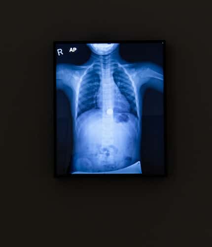 Jill Magid's "Circulation" features a chest X-ray of her young son, who accidentally...