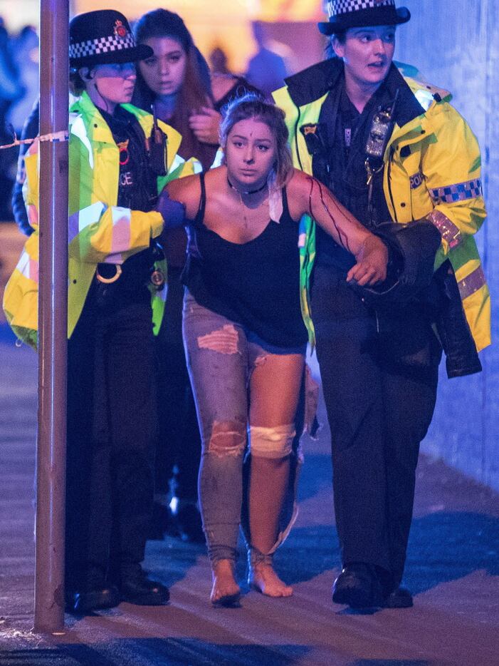 An injured concertgoer is helped by police and emergency responders on Monday after the...