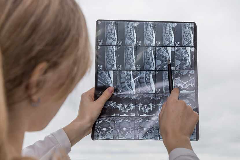 A spine surgeon reviews patient scans
