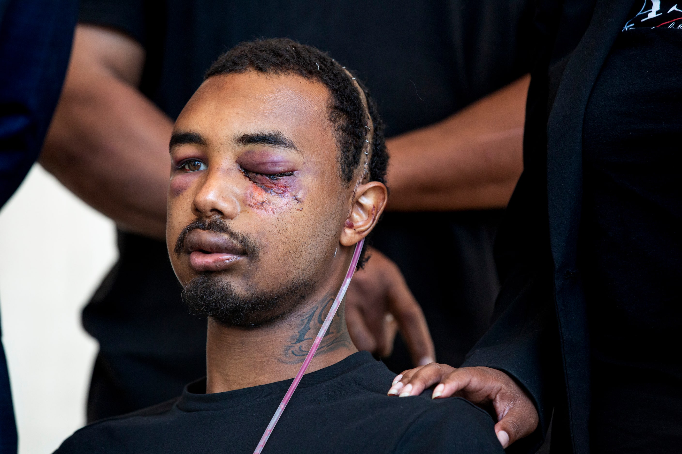 Brandon Saenz, 26, listens as his legal representation explain how Saenz sustained serious...