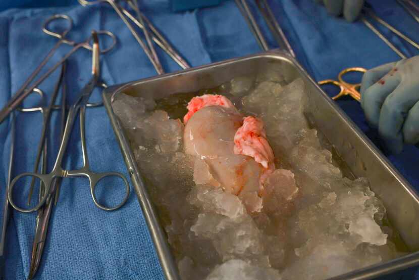 The pig kidney sits on ice, awaiting transplantation at Massachusetts General Hospital on...