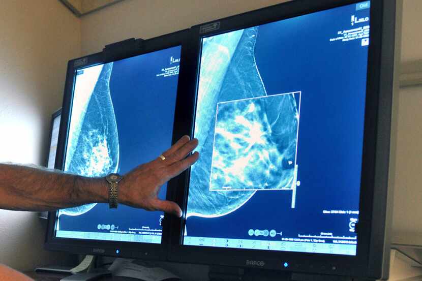 FILE - In this Tuesday, July 31, 2012 file photo, a radiologist compares an image from...