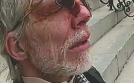Robert Wayne Dennis, left bloodied after fighting with police at the Jan. 6 Capitol riot.
