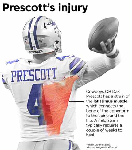 A diagram of Dak Prescott's injury.