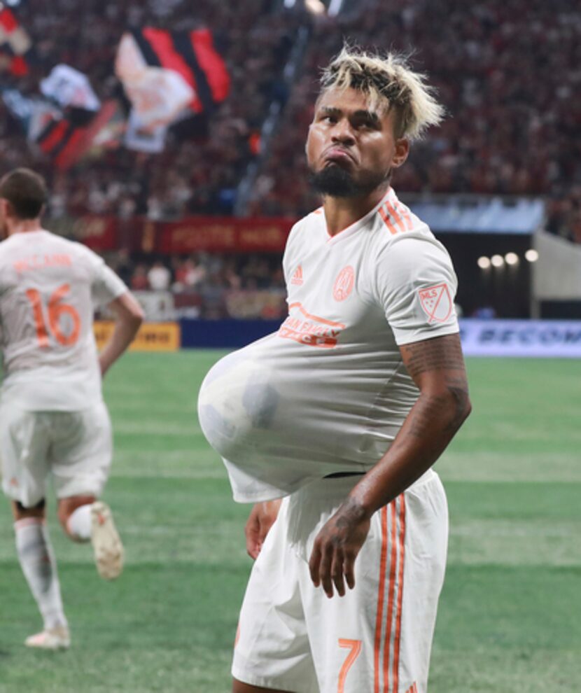 Josef Martinez. (Curtis Compton/Atlanta Journal-Constitution via AP)