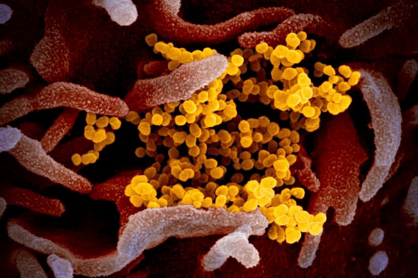 This image shows the novel coronavirus SARS-CoV-2, yellow, emerging from the surface of...