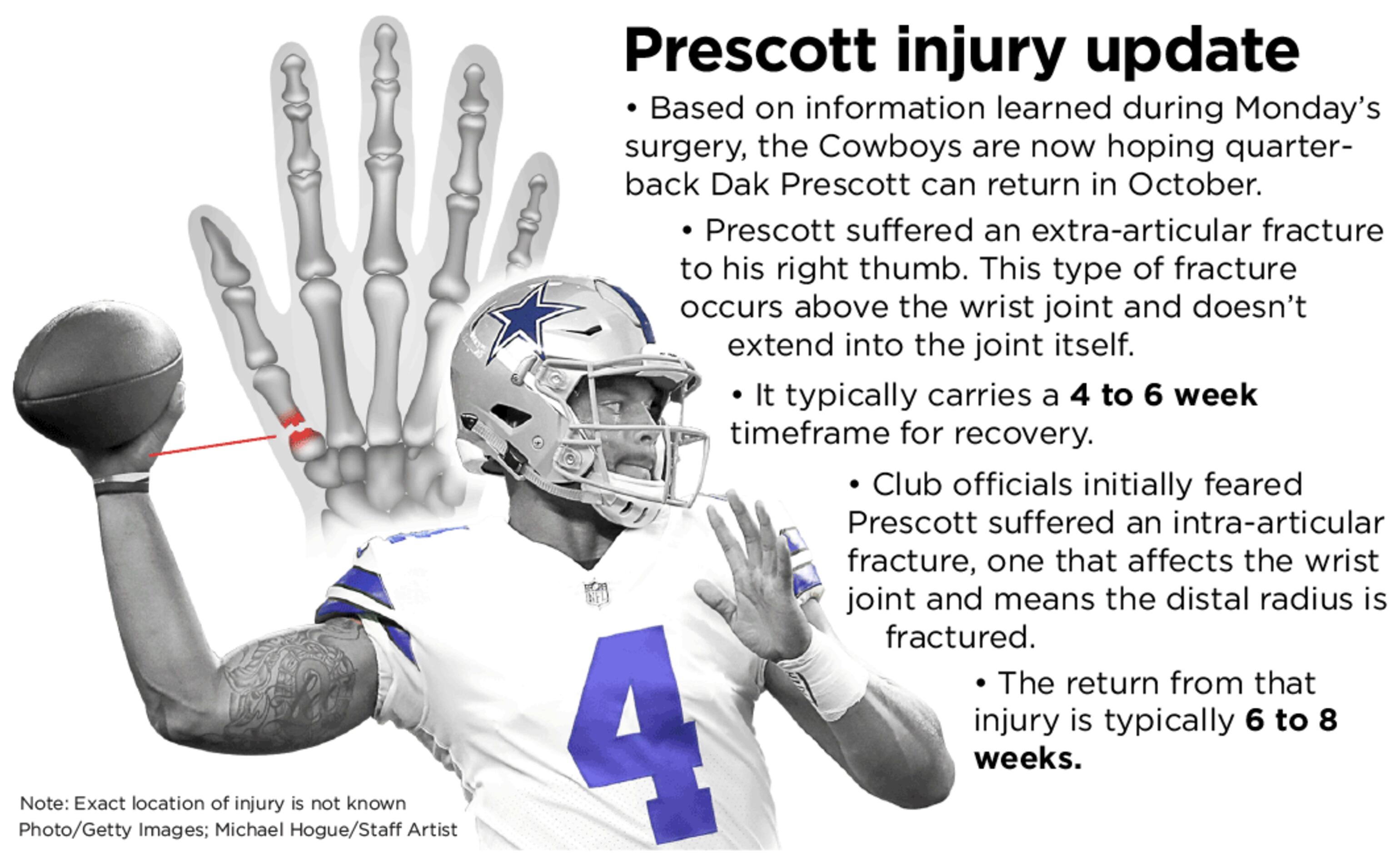 Fantasy Impact: Cowboys QB Dak Prescott Could Miss Two Months