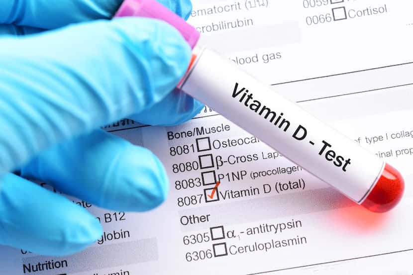 Una prueba de laboratorio médico para determinar niveles de vitamina D en un paciente.(GETTY...