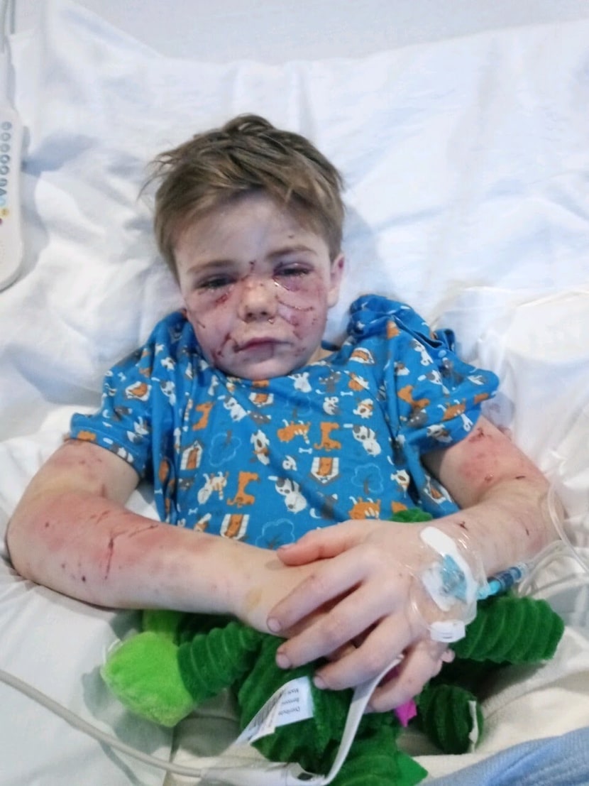 A 7-year-old was attacked by a dog on his walk home from the school bus in Parker County...