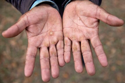 Expelled migrant Antulio Bamaca, from Guatemala, held up his hands at a gazebo in a public...