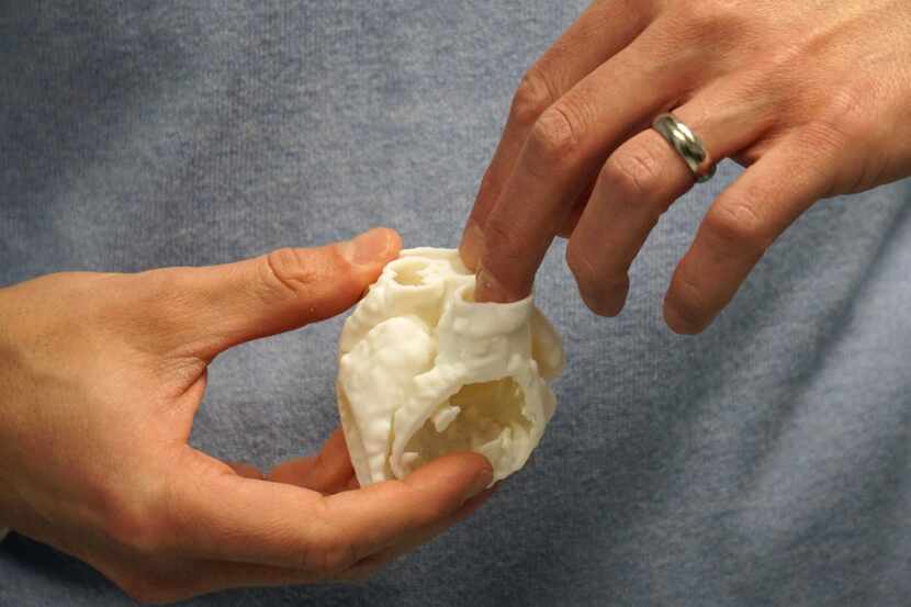 Dr. Steve Muyskens uses a model of a one-year old patients heart to help explain how 3D...