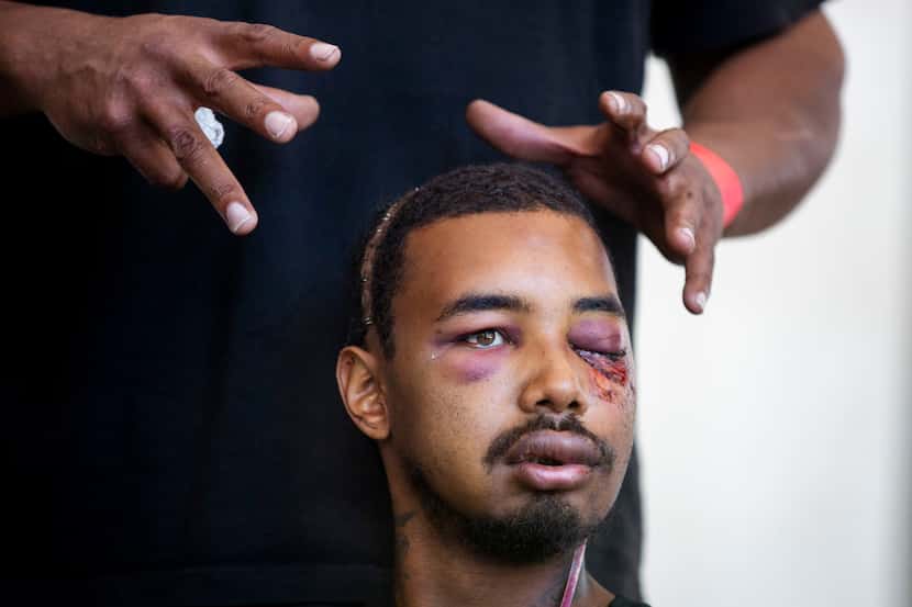 The hands of Andre Ray gesture at the severe injuries sustained in the left eye and head by...