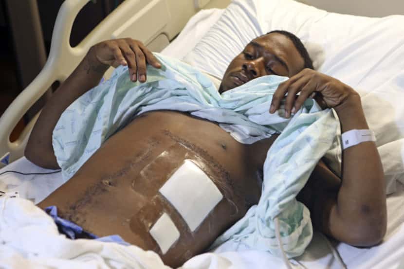 Kelvion Walker showed his scars on Tuesday. Dallas police arrested Reginald Robertson, who...