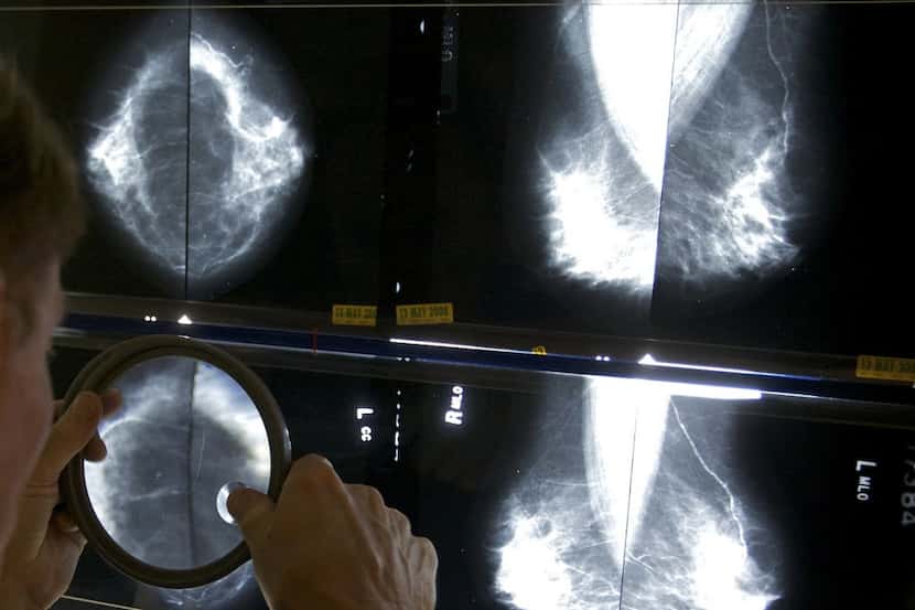 In this May 6, 2010 file photo, a radiologist uses a magnifying glass to check mammograms...