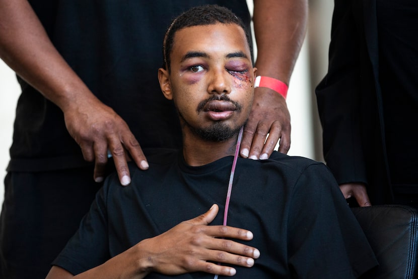 During a June 3, 2020, news conference, Brandon Saenz recalled being hit by a rubber bullet...