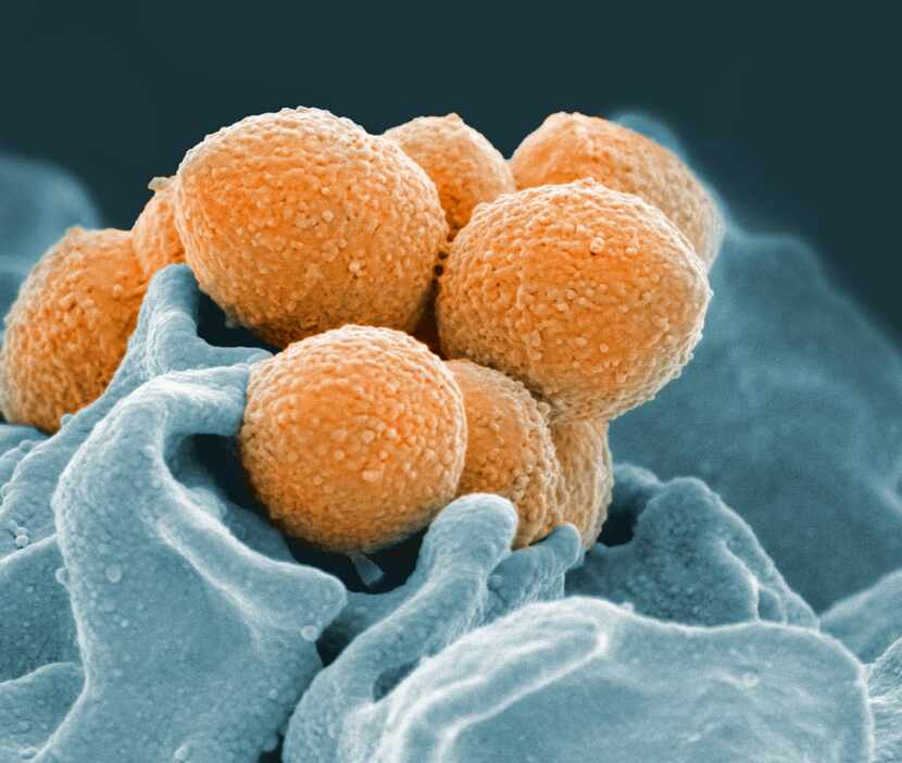 One factor complicating the fight against antibiotic-resistant bacteria is the ability of...