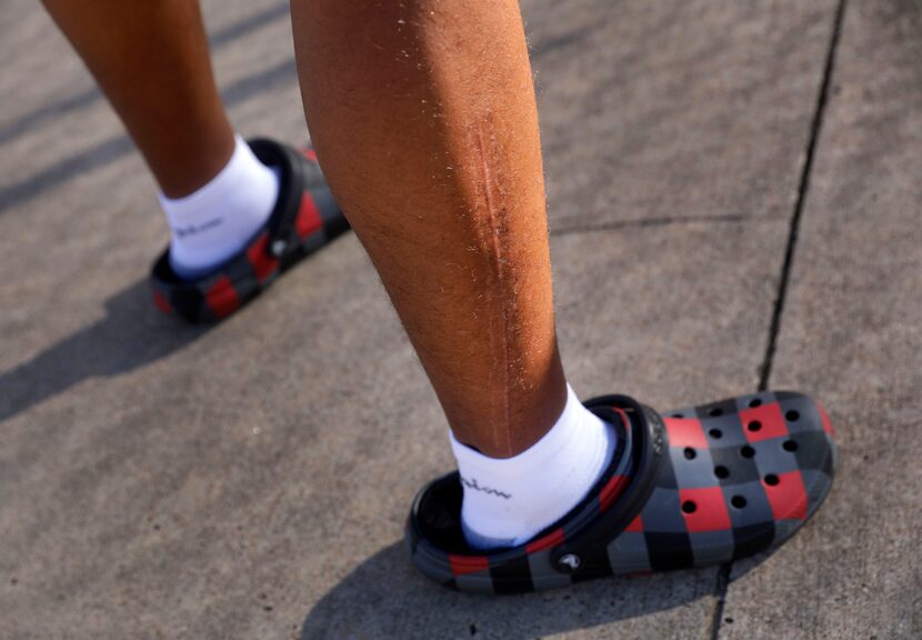 Cedar Hill quarterback Anthony Edwards has a scar the length of his lower right leg where he...