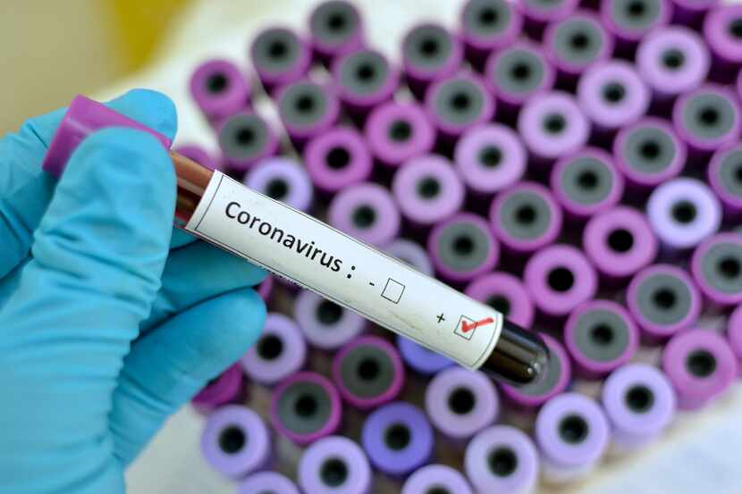 A tube showing a positive result for coronavirus.