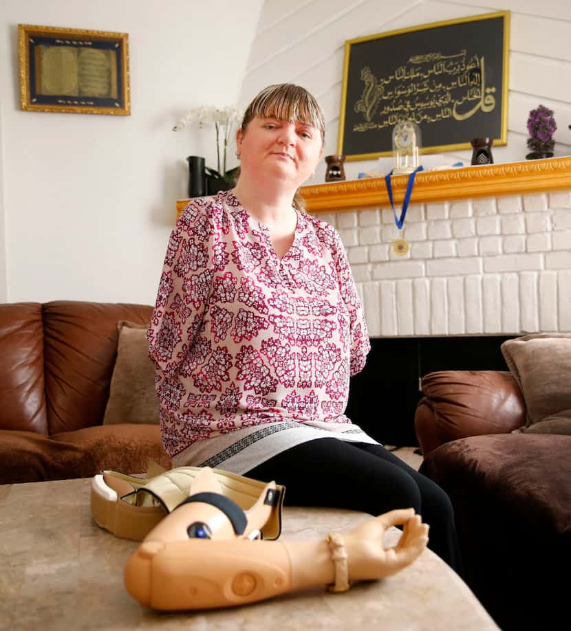 Belma Islamovic, a Bosnian refugee from over 20 years ago, uses prosthetic arms after...
