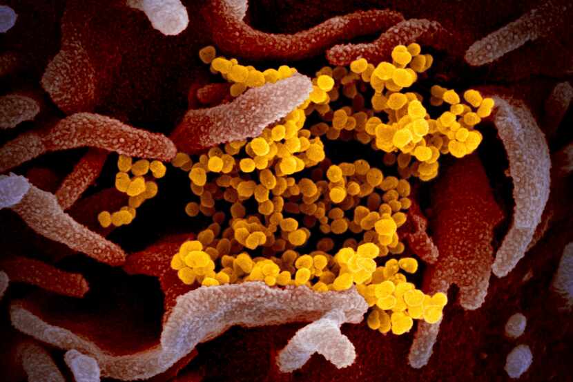 An electron microscope image of the novel coronavirus.