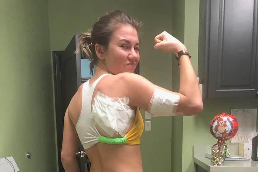 Caitlin Keen got 21 stitches Monday, a day after she was attacked by a dog while running...