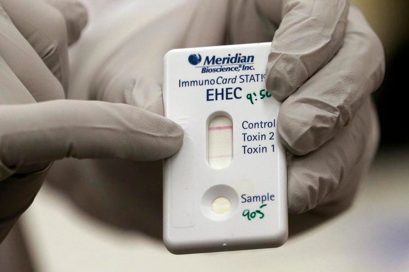 Un microbiólogo muestra una prueba positiva de E. coli en el Departamento de Salud del...