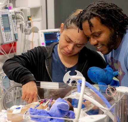 Amanda Arciniega and James Finley comforted their daughter after a surgery that separated...