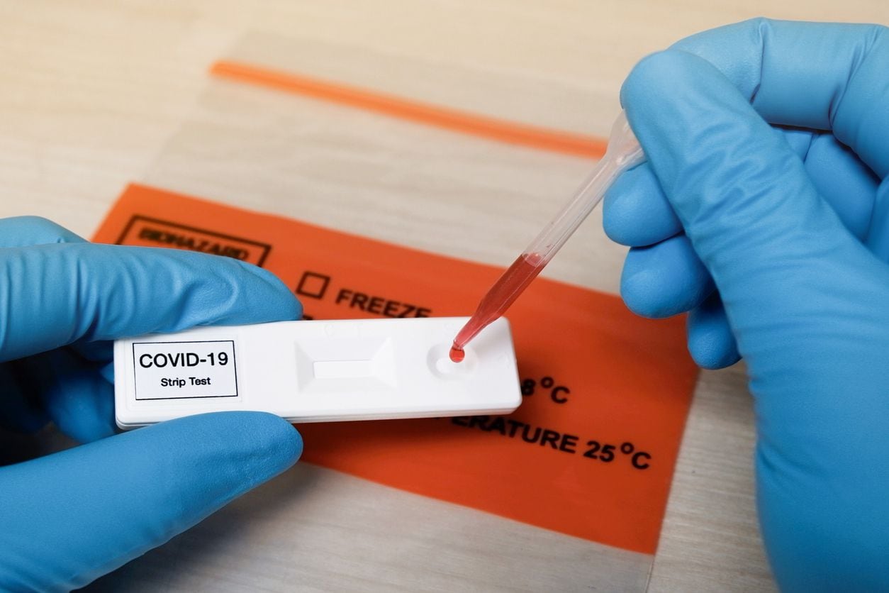 Prueba de sangre para determinar una posible infección de covid-19.