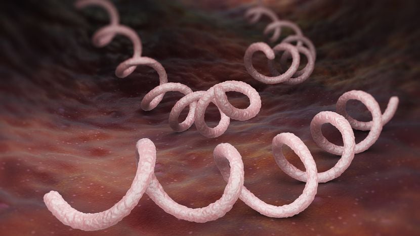 Texas can do more to stop syphilis in newborns